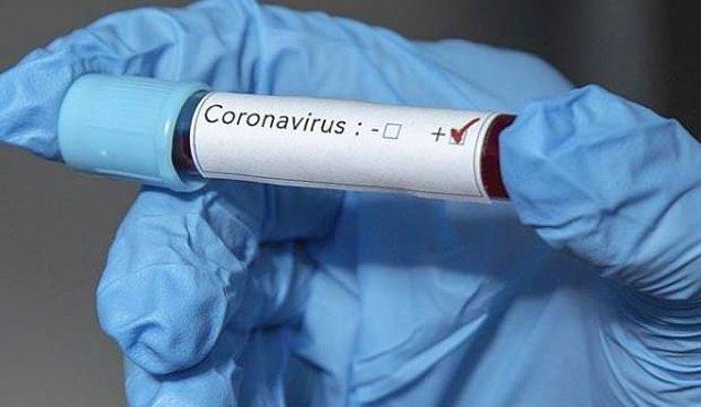 Çin'in Wuhan kentinde ortaya çıkan ve yüzlerce kişiyi öldüren Koronavirüs Türkiye'nin bütün komşu ülkelerinde görülmüştü.