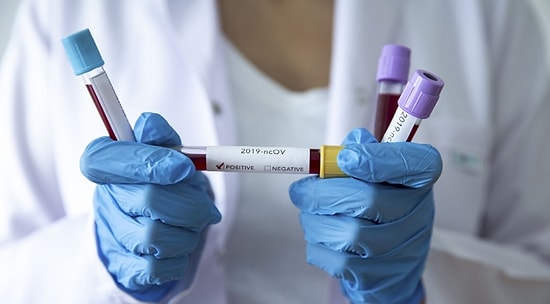 Araştırma: Vatandaşların Yüzde 44'ü 'Koronavirüs Aşısı Bulunsa da Yaptırmam' Dedi