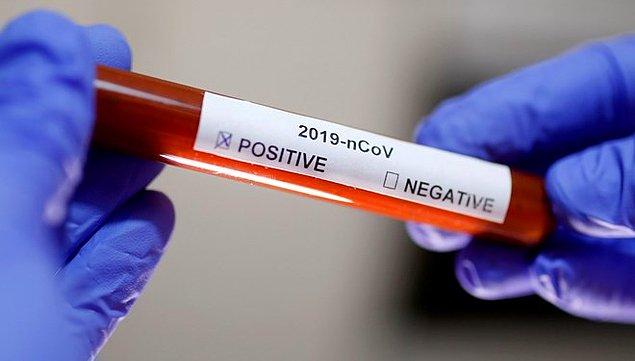 İngiltere'de araştırmacılar aşı geliştirmeye bir adım daha yaklaştı. Avustralya'da da Queensland Üniversitesi Klinik Araştırmalar Merkezi’nde bir ekip de iki ilacın corona virüs tedavisinde kullanılabileceğini açıkladı.