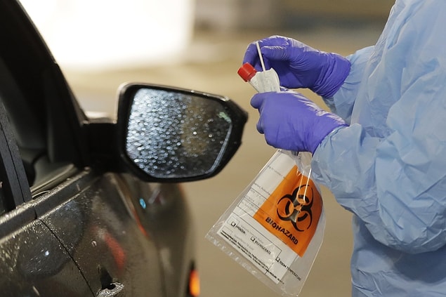 Günde 12 bin kişi test olabiliyor