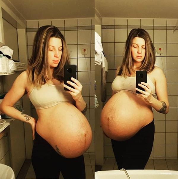 1. Üçüzlere hamile olup, hamileliğinin 33. haftasında olan kadın.