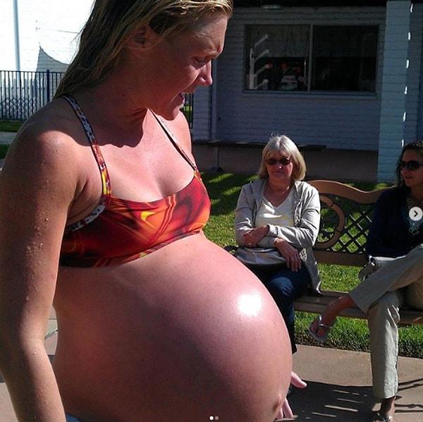 3. 36 haftalık hamile ve üçüz bebek bekleyen kadın.