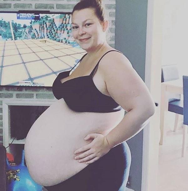 4. 20 haftalık hamile ve ikiz bebek bekliyor.