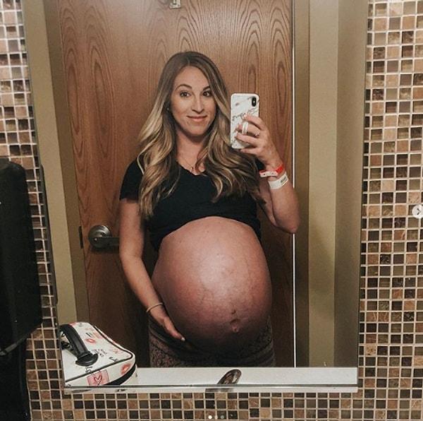 10. 29 haftalık hamile ve dördüz bekleyen kadın.