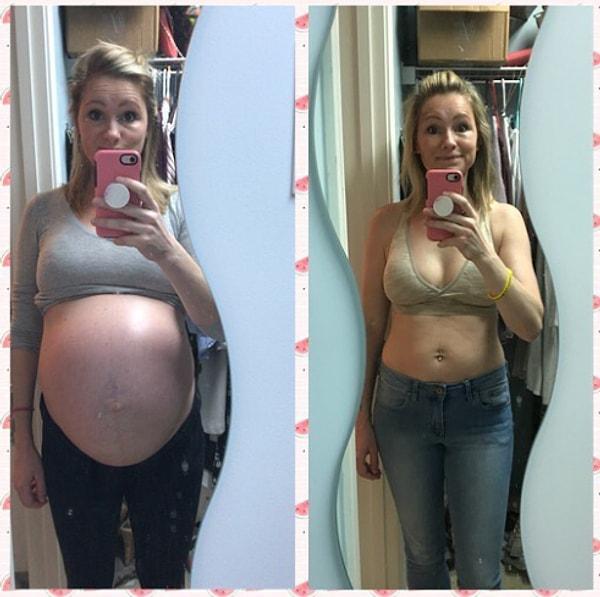 14. Soldaki fotoğrafta hamileliğinin 35. haftasında ve ikiz bebeklerini bekliyor. Sağdaki hali ise doğum yaptıktan sonraki görüntüsü.