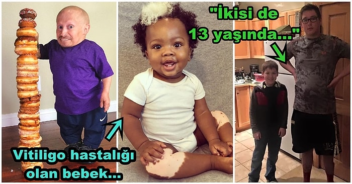 Vücutlarındaki Farklılıklarla Birlikte Bambaşka Anlamlar Kazanarak Hayranlık Uyandıran 17 Kişi