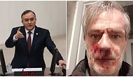MHP Grup Başkanvekili Erkan Akçay’dan Tepki Çeken ‘Dayak’ Paylaşımı: 'Bu Yakışıklı Kim?'