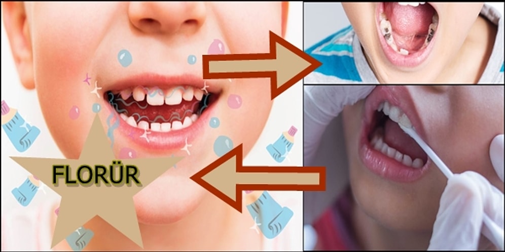 Anne Babaların Kafası Çok Karışık: Diş Macunlarındaki Florür Zararlı mı Değil mi?