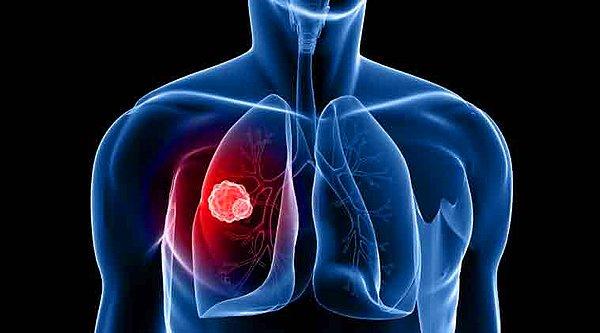 4. Kronik akciğer hastalığı bulunanlar.