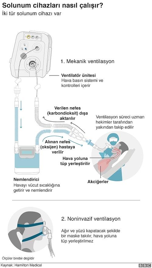 Tüm Dünya 'Solunum Cihazlarının' Peşinde: Peki Türkiye'de Kaç Adet Var? Kovid-19 Hastaları İçin Neden Bu Kadar Önemli?