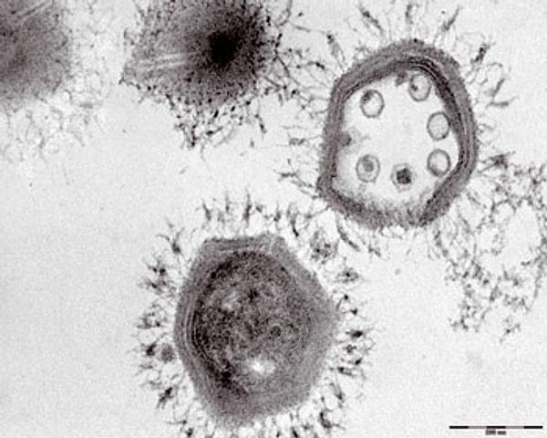 11. Mamavirüs isimli başka bir virüs ise o kadar büyüktür ki, kendine ait Sputnik adında bir virüs uydusu vardır.
