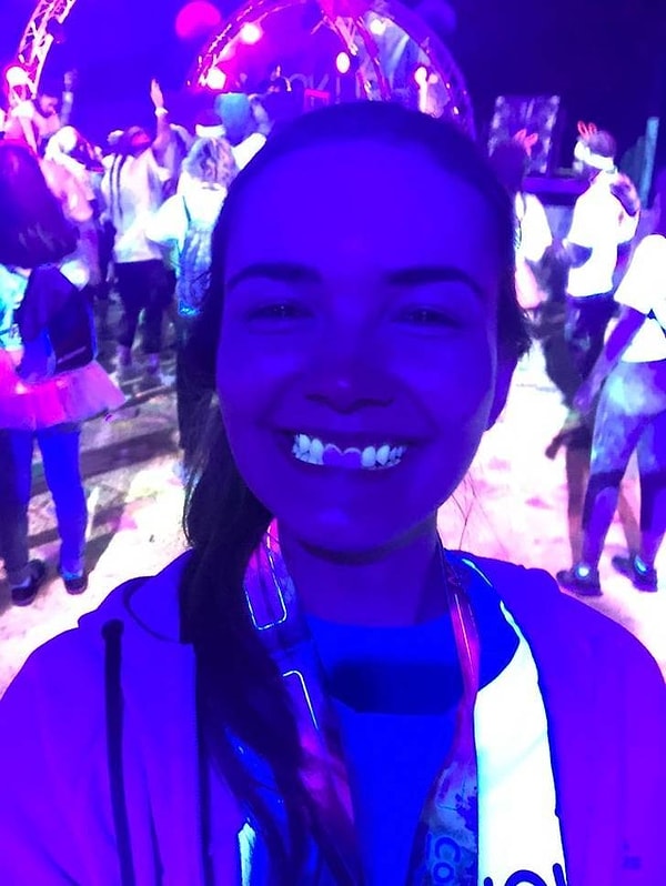 1. Оказывается, что виниры и зубные коронки не светятся под ультрафиолетовым излучением.