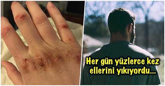 El Yıkama Takıntısından Kurtulmak İçin Kendini Vurup Mucizevi Bir Şekilde İyileşen Adamın Bi’ Garip Hikayesi