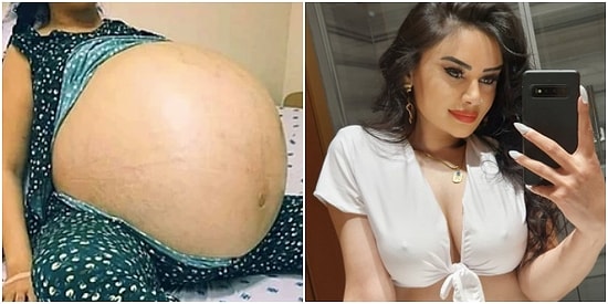 Gördüğünüz Andan İtibaren Gençliğinizden 20 Yılı Çalıp Götürecek Birbirinden Acayip Görseller