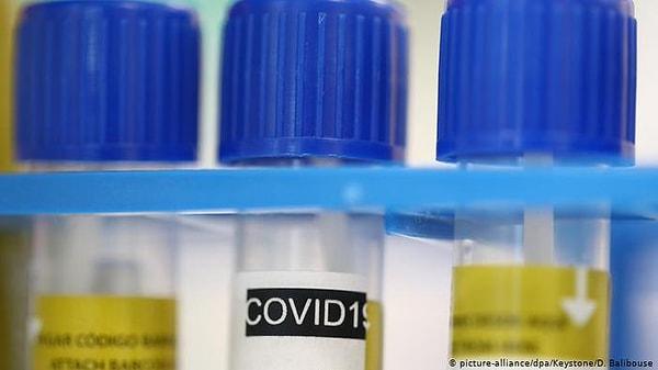 Yeni tip koronavirüs salgınının önüne geçilmesi için bilim insanları tarafından aşı ve tedavi geliştirme çalışmaları hız kesmeden devam ediyor.