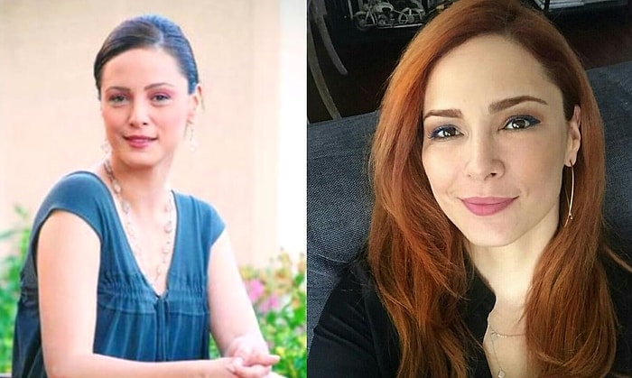 Как выглядят популярные турецкие актрисы до и после пластики?