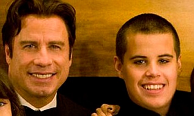 Ünlü oyuncu John Travolta'nın oğlu Jett Travolta 2009 yılında Kawasaki Sendromu sebebiyle hayatını kaybetmişti.
