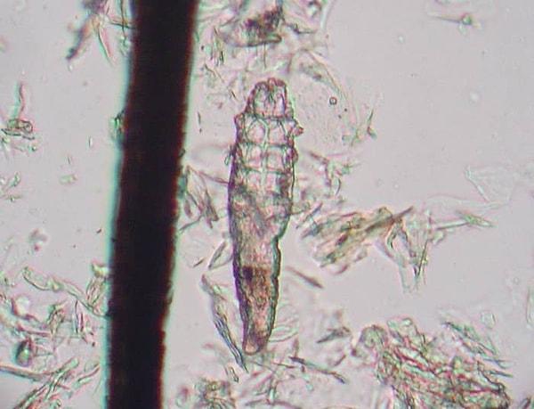 11. Şu anda kirpik diplerinizde, demodex brevis ve demodeks türlerinde akarlar (keneye benzer hayvan) yaşamaktadır.