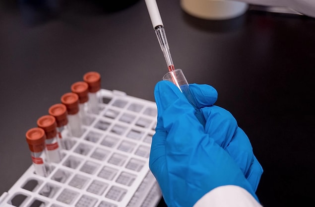 Shi'nin ekibi o zamandan beri yarasalar üzerindeki koronavirüs varyantını tanımladı ve genetik materyallerini oluşturan RNA dizilerine dayanarak birbirleriyle nasıl ilişkilendiklerine dair evrimsel bir ağaç inşa etti.