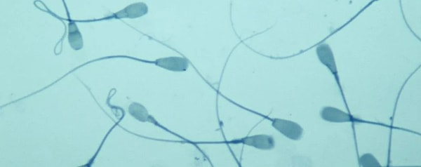 Çinli bilim insanlarının sperm üzerinde Kovid-19 tespit ettiklerini duyurması akılları karıştırdı.