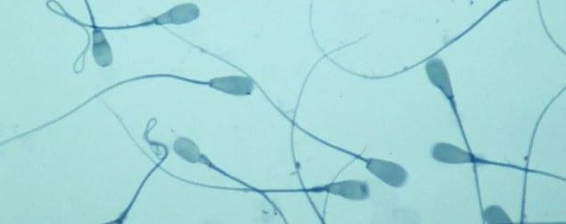 Çinli bilim insanlarının sperm üzerinde Kovid-19 tespit ettiklerini duyurması akılları karıştırdı.