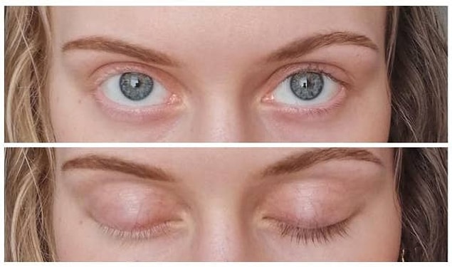 5. Saç ve kirpikleri sarışın ve kumral olarak ayrılmış bu kadın: