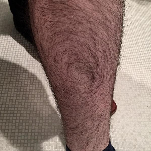 18. "Bacak kıllarım spiral şeklinde uzuyor."