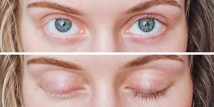 17 людей с различными особенностями тела, которые они просто обожают