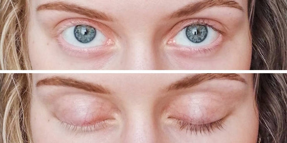 17 людей с различными особенностями тела, которые они просто обожают