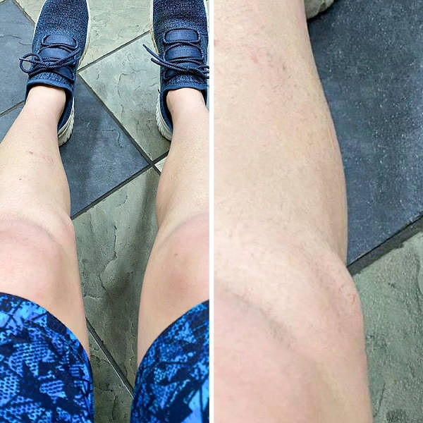 11. «У меня есть "лишняя" кость рядом с коленом, который я люблю называть своей дополнительной коленной чашечкой».