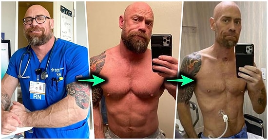 Koronavirüse Yakalanan Bir Sağlık Çalışanının 6 Haftada Geldiği Hali Görünce Epey Şaşıracaksınız!