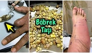 Bakmayı Başarsanız da Midenizi Kaldırıp Kalıcı Travma Yaşatacak İnternet Dehlizlerinden 19 Lanetli Görsel
