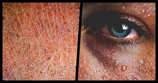 Vücudumuzda Ortaya Çıktığında Yeterli Miktarda Su Tüketmediğimizi Gösteren 15 İlginç Belirti