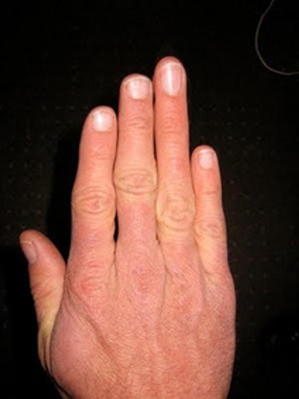 Bilim insanları yüzük parmağının uzunluğunun, anne karnındayken fetüsün maruz kaldığı testosteron oranıyla ilgili olduğunu söylüyorlar.