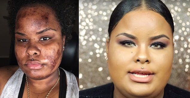 Zoe bu fotoğrafın ardından insanların daha fazla dikkat edeceğini umuyor ve danışmadan kendi kendilerine maske yapmamaları gerektiğini bir kez daha vurguluyor.