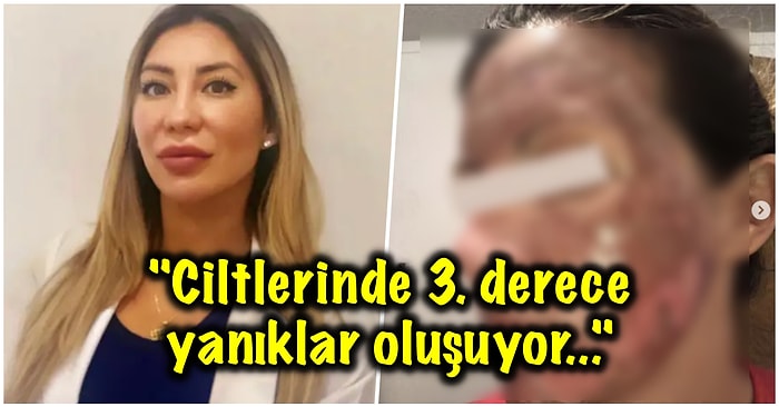 Güzelleşme Uğruna Evde Yaptıkları Kimyasal Maskelerle Ciltlerini Mahveden İnsanların Ürkütücü Hallerine Çok Şaşıracaksınız!