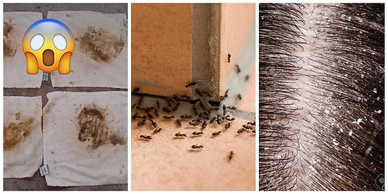 Bakteri Kolonileri Tarafından Rehin Alınmamıza Neden Olan 17 Utanılası Alışkanlık