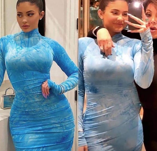 Интерес к пластике вырос под влиянием знаменитостей. А с добавлением фильтров и приложений для фотошопа все окончательно вышло из-под контроля.