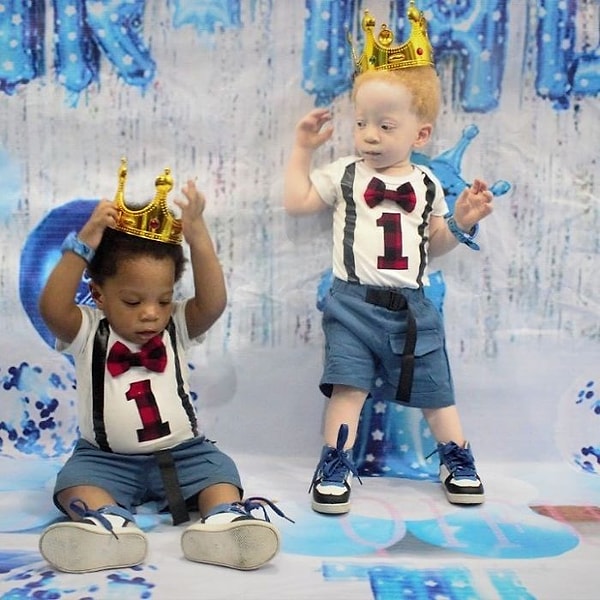 Эти уникальные мальчики недавно отпраздновали свой первый день рождения