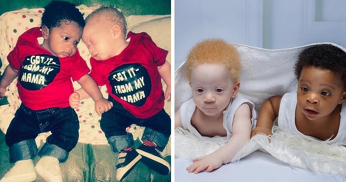 Маму маленьких близнецов, с разным цветом кожи, часто спрашивают, кто из мальчиков ее сын