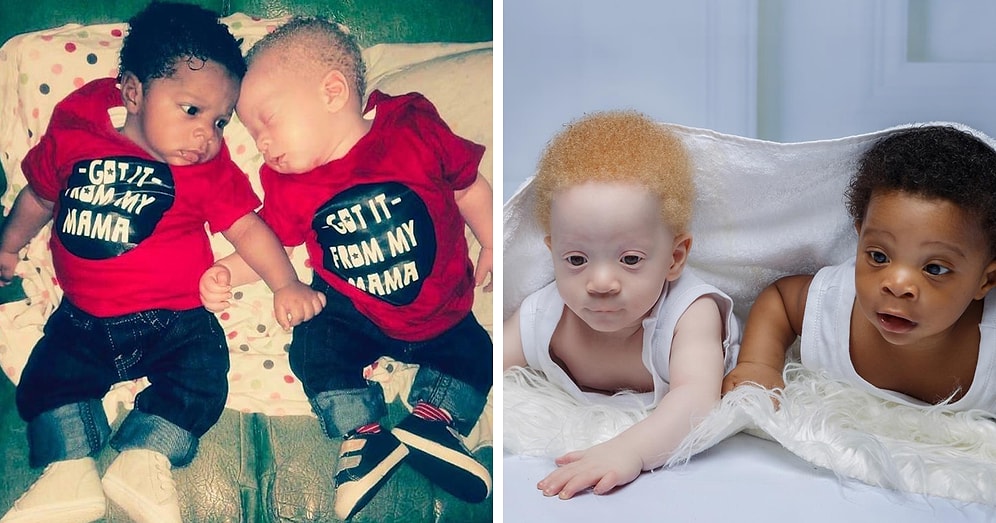 Маму маленьких близнецов, с разным цветом кожи, часто спрашивают, кто из мальчиков ее сын