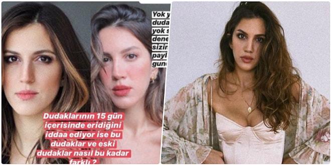 Dudağında Dolgu Olmadığını Söyleyen Arda Türkmen'in Sevgilisi Melodi Elbirliler'e Estetik Kliniğinden Yalanlama Geldi!