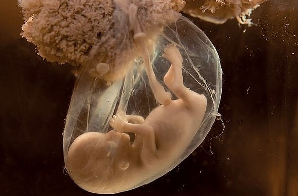 15. Каждый ребенок в утробе матери растет со слоем волос, которые образуются в утробе матери, а затем распространяются по всему телу.