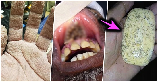 Bakmayı Başarsanız da Midenizi Kaldırıp Kalıcı Travma Yaşatacak İnternet Dehlizlerinden 14 Lanetli Görsel