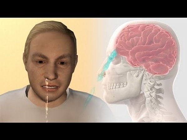 9. То, что вы принимаете за сопли, на самом деле может быть спинномозговой жидкостью!