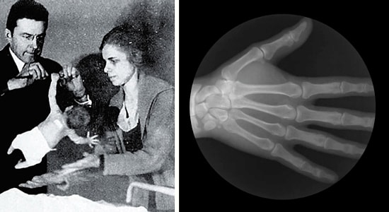 10 интересных фактов о человеческом теле, которые заставят вас подпрыгнуть от удивления