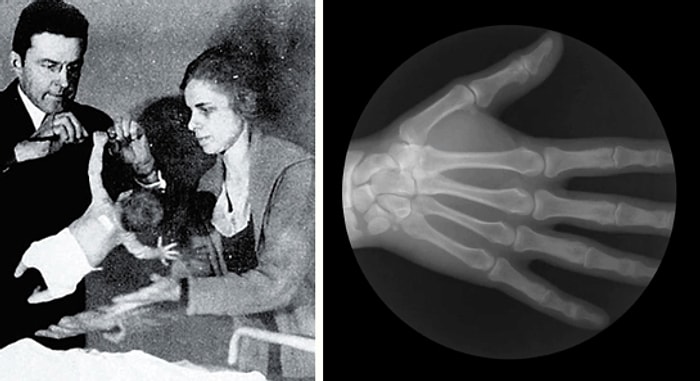 10 интересных фактов о человеческом теле, которые заставят вас подпрыгнуть от удивления