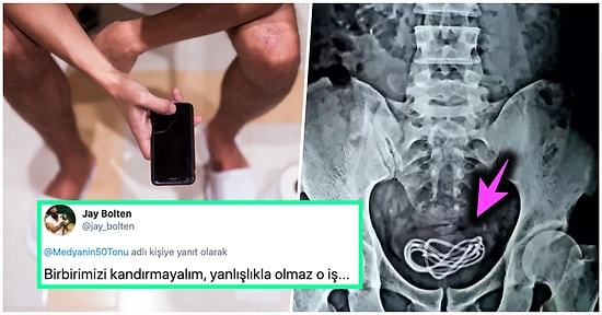 Şiddetli Ağrılara Dayanamayıp Gittiği Hastanede Makatına Sıkışmış Bir Balık Olduğunu Öğrenen Talihsiz Adam
