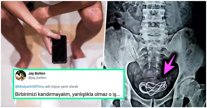 Şiddetli Ağrılara Dayanamayıp Gittiği Hastanede Makatına Sıkışmış Bir Balık Olduğunu Öğrenen Talihsiz Adam
