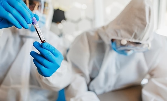 Bilim Kurulu Üyesi Prof. Dr. Seçil Özkan'ın Açıkladığı Antikor Testi ve Serolojik Test Nedir?
